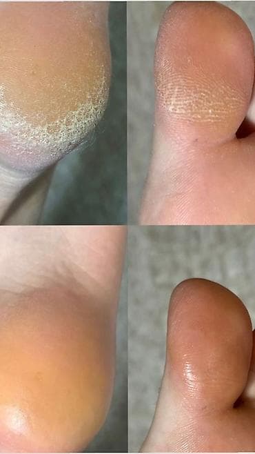 Покрытие гель лаком, Педикюр, Одноразовые расходные материалы — 3