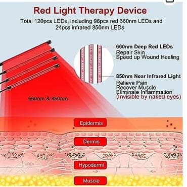 аргон для суставов: ❄️Физиотерапия для суставов и не только - инфракрасный свет для — 10