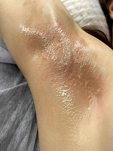 Шугаринг и восковая депиляция - Зоны: подмышки, руки, ноги, бикини и at lalafo.kg Шугаринг и восковая депиляция - Зоны: подмышки, руки, ноги, бикини и