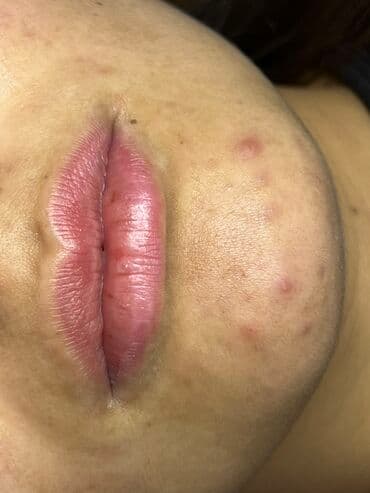 самый лучший эндокринолог рядом просп жибек жолу бишкек: Косметология, Маски, Мезотерапия, Удаление носогубных складок, Гипоаллергенные материалы, Консультация, Сертифицированный косметолог — 2