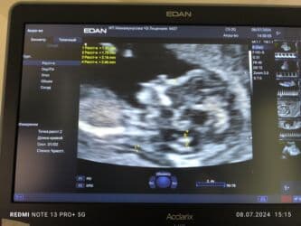 Пульсоксиметры: Ультразвуковая диагностическая аппарат 2024 года выпуска - — 7