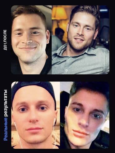 аппарат от храпа: 🔥 ЭСПАНДЕР ДЛЯ СКУЛ — НАГРУЗКА 40 КГ 🔥 Хочешь чёткие, выраженные — 6