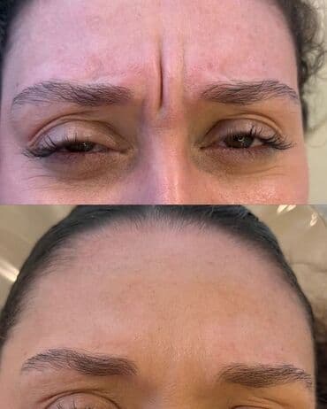 самый лучший эндокринолог рядом просп жибек жолу бишкек: Косметология, Ботокс, Консультация, Гипоаллергенные материалы, Сертифицированный косметолог — 2