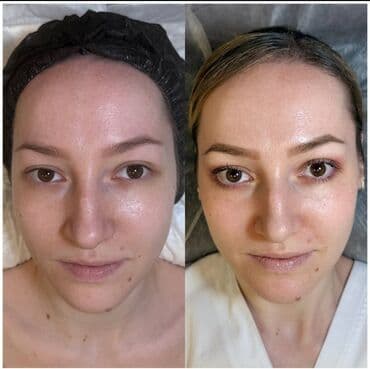 медицинский массаж курсы: Косметология, Демодекоз, Контурное моделирование, Лечение угревой болезни, Консультация, Гипоаллергенные материалы, Сертифицированный косметолог — 16