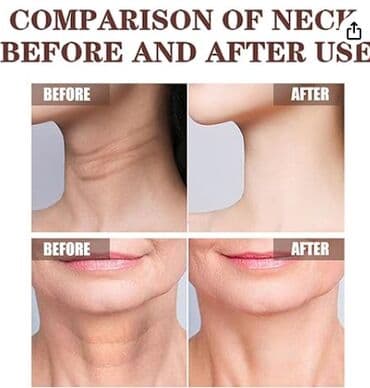 Киреге берилүүчү кийимдер: США Крем укрепляющий с черным чаем и решение 5 проблем кожи — 14