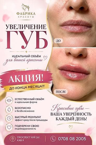 ботокс губы: Описание: - Идеальный объём и аккуратная форма для гармоничных черт — 1