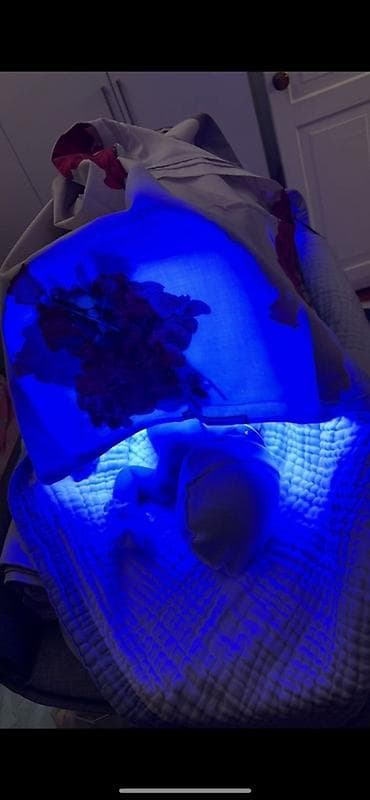 часы карта: Фотолампа от желтушки — 1