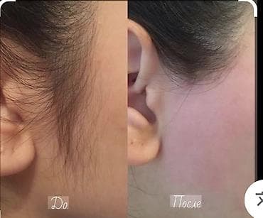 iphone battery: IPhone 17 Pro Max — 1