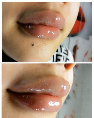 сколько стоит обучение на маникюр: Косметология, Биоревитализация, Ботулинотерапия, Сертифицированный косметолог, Гипоаллергенные материалы, Консультация — 26