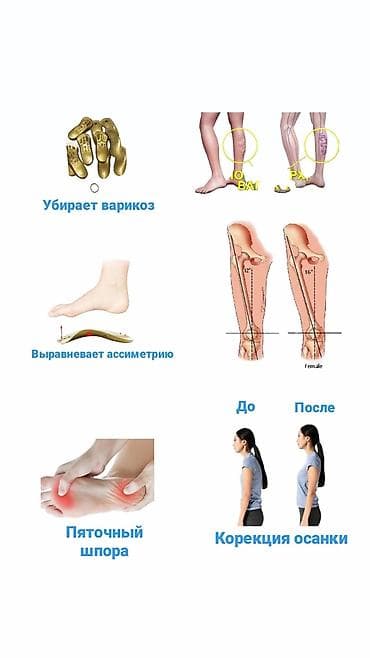 Массаж | Лечебный массаж | Остеохондроз, Межпозвоночная грыжа, Протрузия | Консультация at lalafo.kg Массаж | Лечебный массаж | Остеохондроз, Межпозвоночная грыжа, Протрузия | Консультация