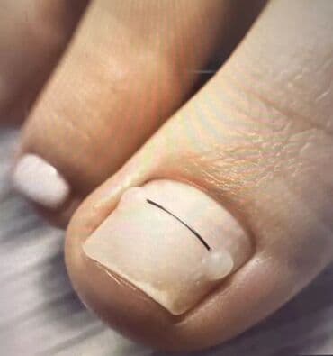 на дом керек: Услуги подолога, С выездом на дом, Консультация, Одноразовые расходные материалы — 4