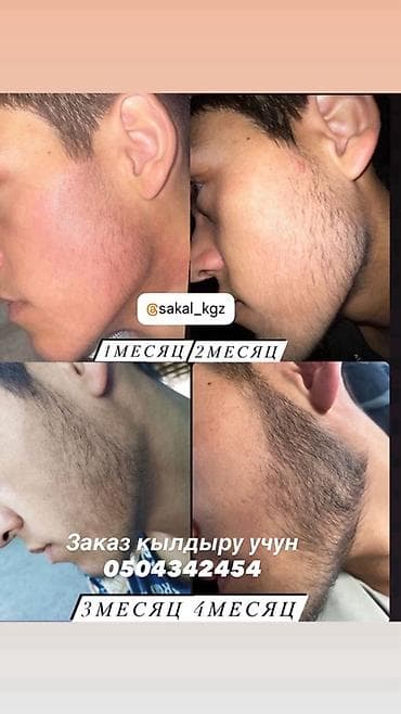 дифферин крем неман: Витамины E, Для роста волос, Универсальный, Жидкость — 3