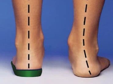 Стельки ортопедические(специализированные) от плоскостопия! Для at lalafo.kg Стельки ортопедические(специализированные) от плоскостопия! Для