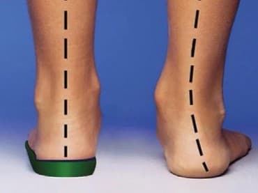 Стельки ортопедические(специализированные) от плоскостопия! Для at lalafo.kg Стельки ортопедические(специализированные) от плоскостопия! Для