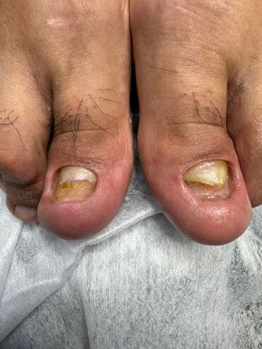 самый лучший эндокринолог рядом просп жибек жолу бишкек: Наращивание ногтей, Укрепление ногтей, Ремонт сломаных ногтей, Маникюр, Педикюр, С выездом на дом, Консультация, Одноразовые расходные материалы — 4