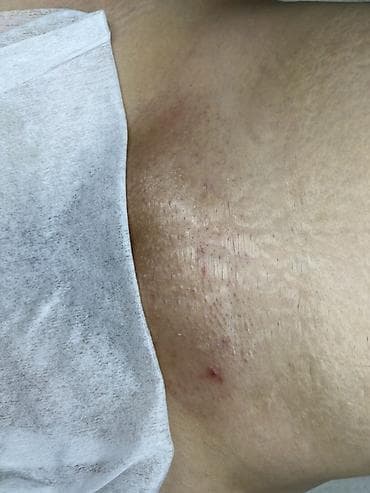 центр витилиго: 🔥 PRIVATE SPA БИКИНИ — ЖЕКЕ КАБЫЛ АЛУУ Восковая депиляция + SPA уход — 2