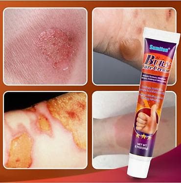 bluesky shellac: ❄️ крем от ожогов только звонки так же смотрите профиль - — 3