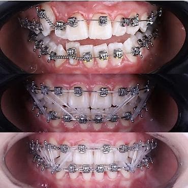 ортопедическое кресло бишкек: Скамейка Металл — 8