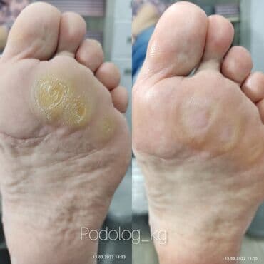 сколько стоит обучение на мастера маникюра: Коррекция вросших ногтей, Маникюр, Педикюр, Услуги подолога, Консультация — 4