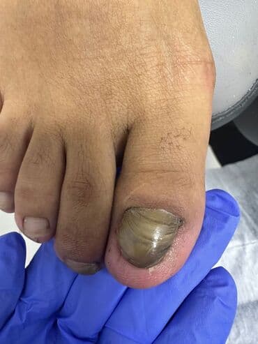 сколько стоит обучение на мастера маникюра: Коррекция вросших ногтей, Маникюр, Педикюр, Услуги подолога, Консультация, Одноразовые расходные материалы — 17