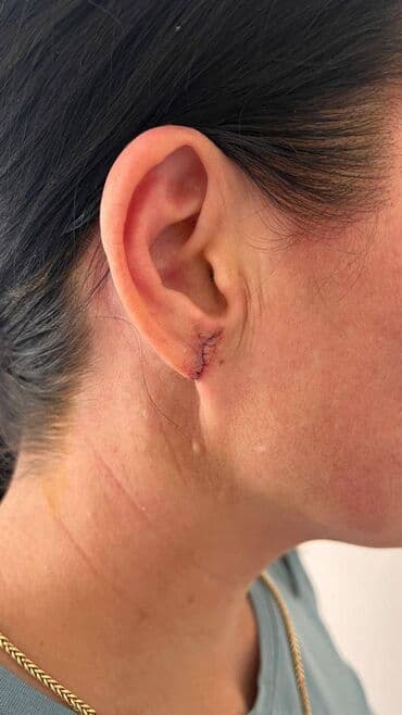 хирургия: Клиника, Врачи | Хирург — 5