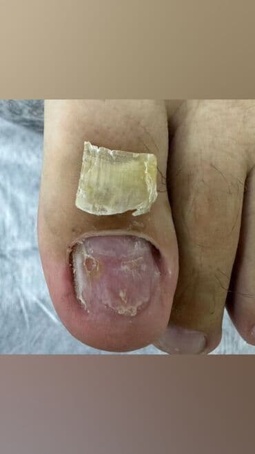 сколько стоит обучение на мастера маникюра: Коррекция вросших ногтей, Маникюр, Педикюр, Услуги подолога, Консультация, Одноразовые расходные материалы — 9