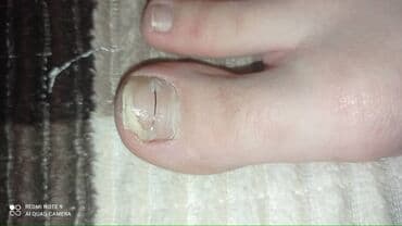 самый лучший эндокринолог рядом просп жибек жолу бишкек: Воосшие ногти, заболевания ногтей, стопы, бородавки, мозоли — 12