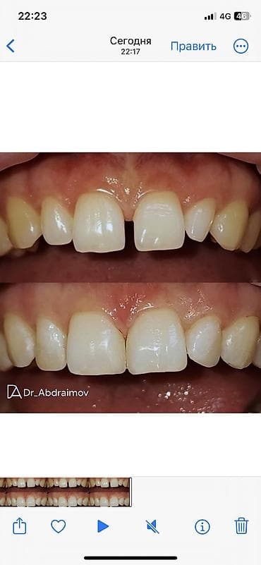 жумуш баня: Дарыгерлер | Стоматолог | Диагностика, Консультация, Башка медициналык кызматтар — 5