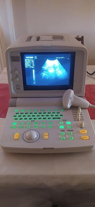 Продам . Портативный УЗИ аппарат с конвексным датчиком. Прошу 55000 lalafo.kg да Продам . Портативный УЗИ аппарат с конвексным датчиком. Прошу 55000