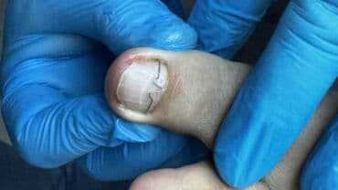 арендовать дом: Выравнивание, Услуги подолога, С выездом на дом, Консультация, Одноразовые расходные материалы — 41