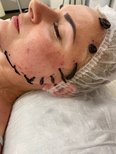 медицинский массаж курсы: Косметология, Демодекоз, Контурное моделирование, Лечение угревой болезни, Консультация, Гипоаллергенные материалы, Сертифицированный косметолог — 20