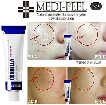 cream: Успокаивающий крем с экстрактом центеллы для чувствительной — 3