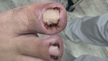 на дом керек: Услуги подолога, С выездом на дом, Консультация, Одноразовые расходные материалы — 22