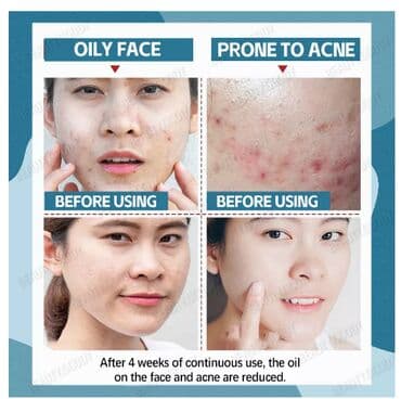 корейские бады день и ночь отзывы: ❄️ США Крем с керамидами антивозрастной увлажняющий Крем с керамидами — 5