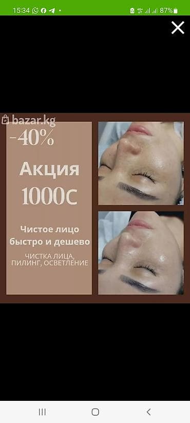 акнекутан цена: Чистка лица + пилинг для осветления Комплексная процедура — 7