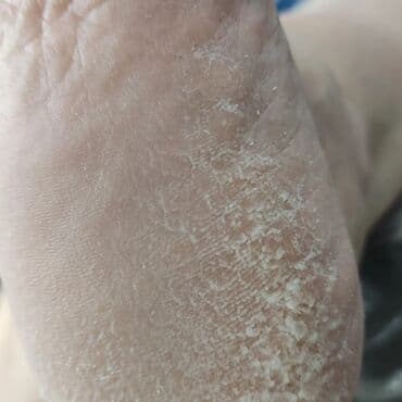 кресло барбер: Сынган тырмактарды оңдоо, Ичине кирип өскөн тырмактарды оңдоо, Педикюр, Консультация, Бир жолку сарпталуучу материалдар — 7