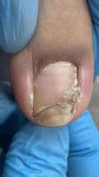 арендовать дом: Выравнивание, Услуги подолога, С выездом на дом, Консультация, Одноразовые расходные материалы — 28