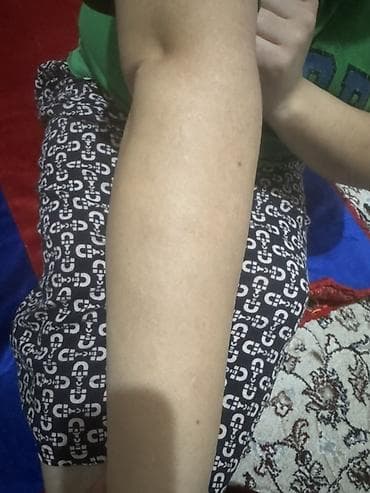 удаление попиломы: Нужны модели на шугаринг,буду делать дома.Оплата только за материал — 2