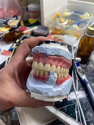 зубной техник: Зуботехническая лаборатория: Качество в каждой детали! 🛠️ — 1