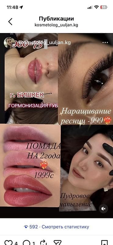 Косметологические услуги в г. Бишкек (мкр. Джал): - Гормонизация губ — 4
