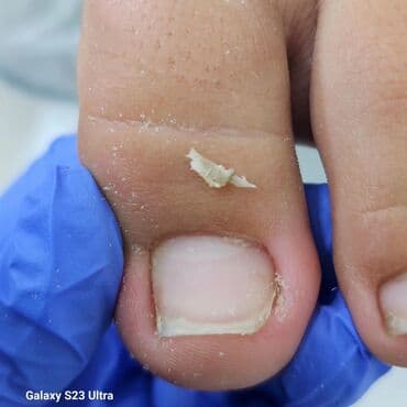 самый лучший эндокринолог рядом просп жибек жолу бишкек: Коррекция вросших ногтей, Услуги подолога, Маникюр, Педикюр, Одноразовые расходные материалы, Консультация — 3