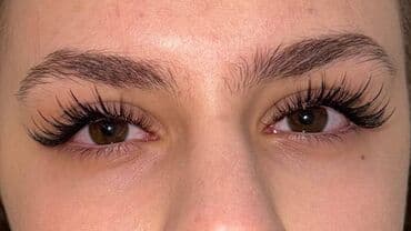 узи с выездом на дом бишкек: Ресницы, Консультация — 4