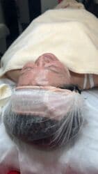 гель для узи: Комбинированная чистка лица: механическая + ультразвуковая — 12