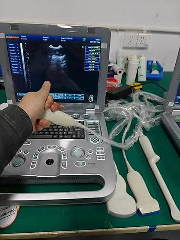 Ингаляторы, небулайзеры: Портативный ультразвуковой аппарат SUNBRIGHT (ноутбучный форм‑фактор) — 4