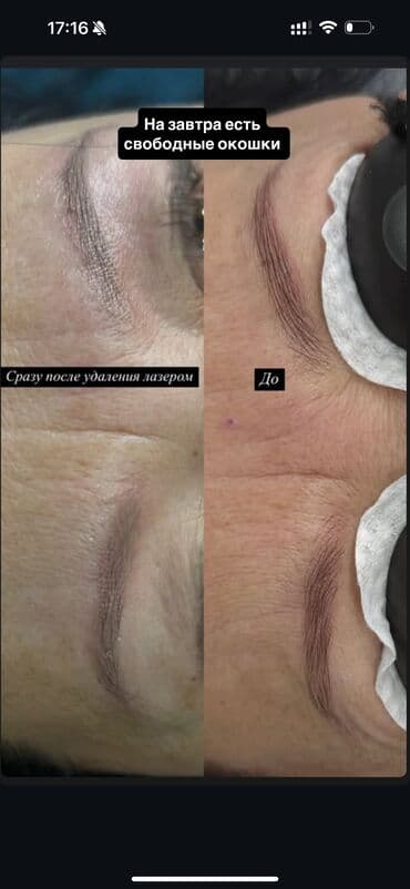 сколько стоит обучение на мастера маникюра: АКЦИЯ !АКЦИЯ! Новый метод удаления Сейчас по акции Лазерное удаление — 7