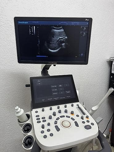 узи скрабер: Продается УЗИ аппарат SonoScape P10 в идеальном состоянии,без — 5