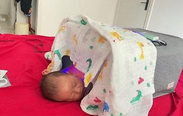 эластичный бинт: Аренда фотолампы для лечения неонатальной желтухи (домашняя — 3