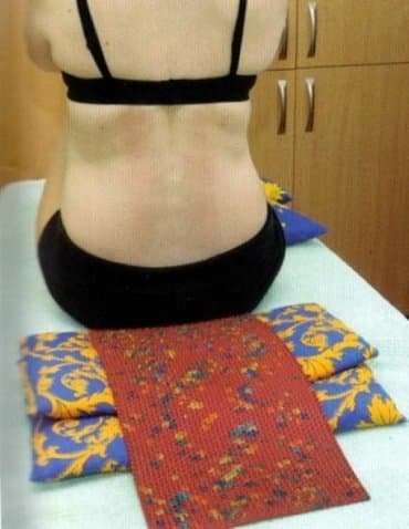 аплекатор кузнецова: Игольчатые Аппликаторы и массажеры "Ляпко". Оказывает — 4