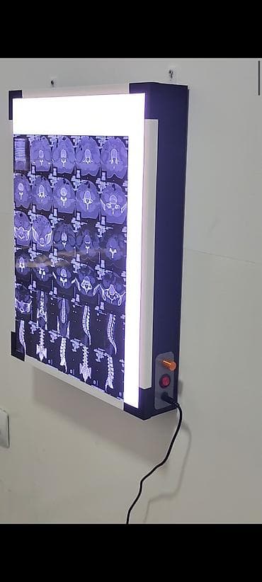 керасиновая лампа: Просветитель (негатоскоп) для рентгеновских пленок и МРТ/КТ-снимков - — 2