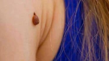 Детские сады, няни: Косметология, Чистка кожи, Консультация, Гипоаллергенные материалы — 17